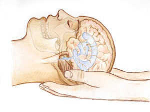 cranio sacrale